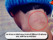 जरा सी बात पर तीसरी क्लास के छात्र को प्रिंसिपल ने दी खौफनाक सजा, तस्वीरें देख रह जाएंगे हैरान