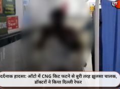दर्दनाक हादसा: ऑटो में CNG किट फटने से बुरी तरह झुलसा चालक, डॉक्टरों ने किया दिल्ली रेफर