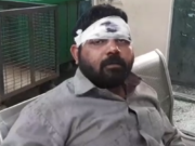 सनसनीखेज वारदात: बहन को ससुराल छोड़ने आए भाइयों ने जीजा का किया ऐसा हाल कि…