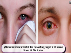 हरियाणा के गोहाना में तेजी से फैल रहा आई फ्लू ! स्कूलों में की स्वास्थ्य विभाग की टीम ने जांच
