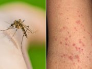 हिसार में लगातार फैल रहा डेंगू..349 मामले आए सामाने