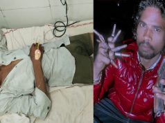 दयानंद कॉलोनी फायरिंग मामले में पुलिस मुठभेड़, दो आरोपी पैर में गोली लगने से घायल